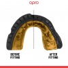 OPRO BUCAL GOLD BRACES NEGRO