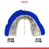 OPRO BUCAL GOLD BRACES NEGRO