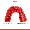 OPRO BUCAL BRONCE